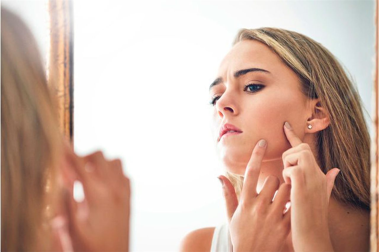 5 cosas que tu acne te está intentando decir sobre tu salud