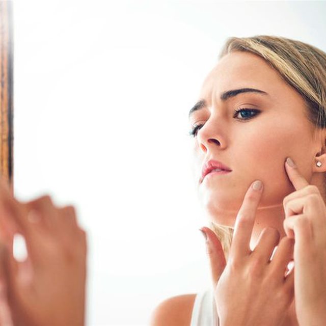 5 cosas que tu acné te está intentando decir sobre tu salud