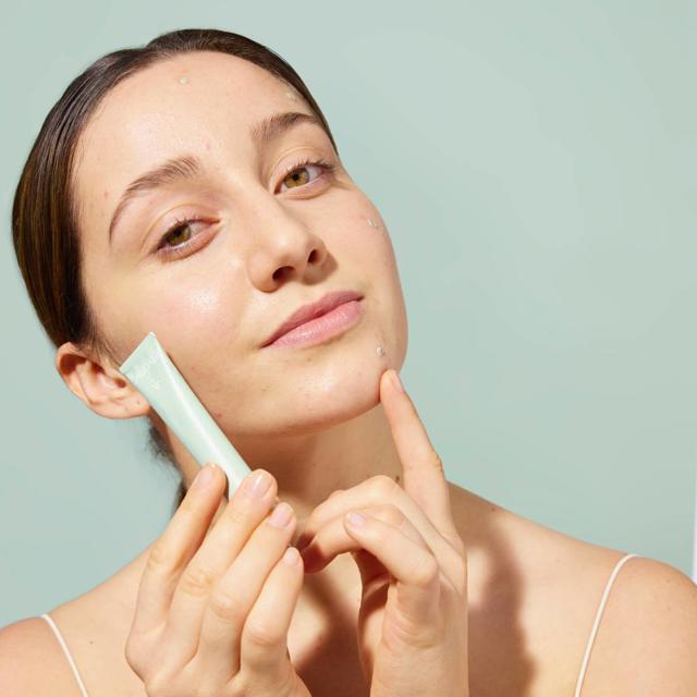 Efecto rebote del acné tras las vacaciones: esta es la mejor manera de recuperar tu piel después del verano